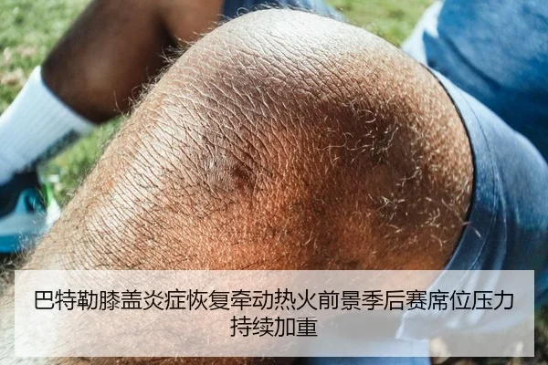 巴特勒膝盖炎症恢复牵动热火前景季后赛席位压力持续加重
